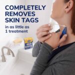 Dr. Scholl's Freeze Away Skin Tag Remover, 8 Ct - Image 2
